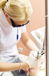 Дәрігер фототермолиз процедурасын орындайды