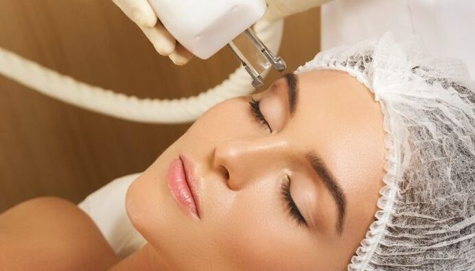 Термолифтинг