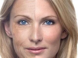 Терінің пигментациясы